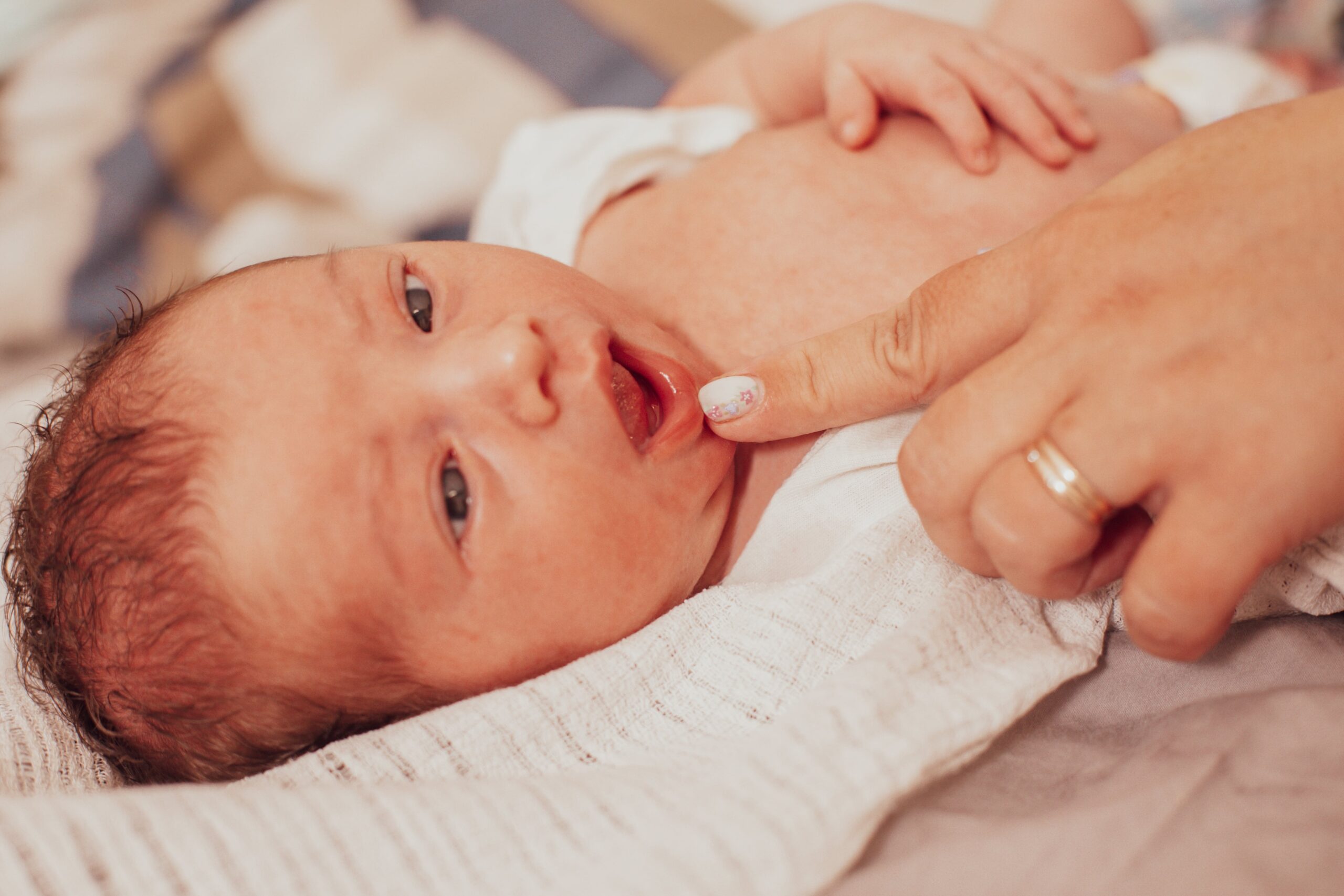 Baby with tongue tie.